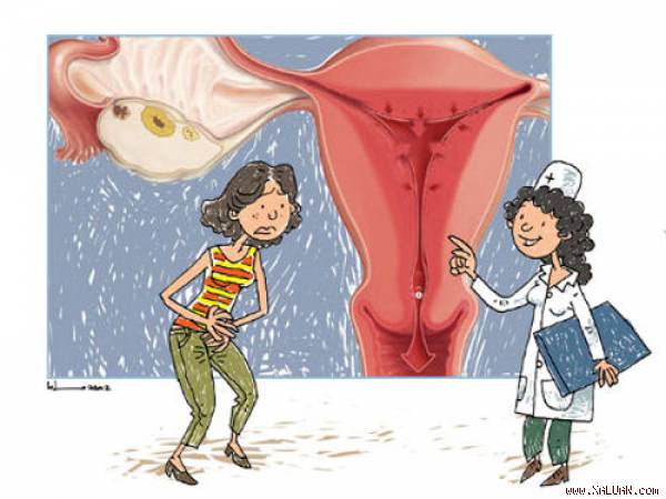 Những điều phụ nữ cần biết về lạc nội mạc tử cung